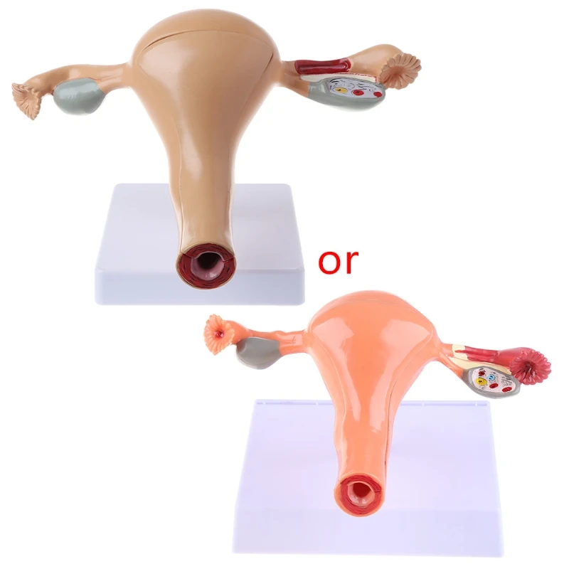 Модель патологической матки яичников человека, анатомическая анатомия, патологоанатомический медик